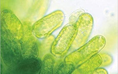Microalgae: Cultivation, Recovery of Compounds and Applications