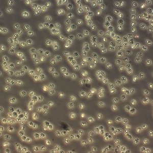 Phaeocystis - 3 -NordsjÃ¸en apr 2015