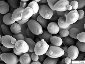 Saccharomyces_cerevisiae_SEM-1024x661