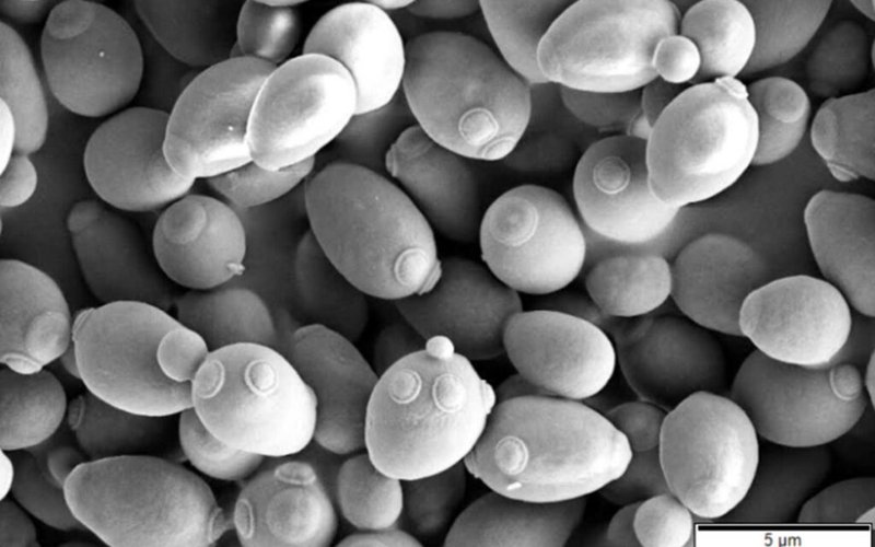 Saccharomyces_cerevisiae_SEM-1024x661